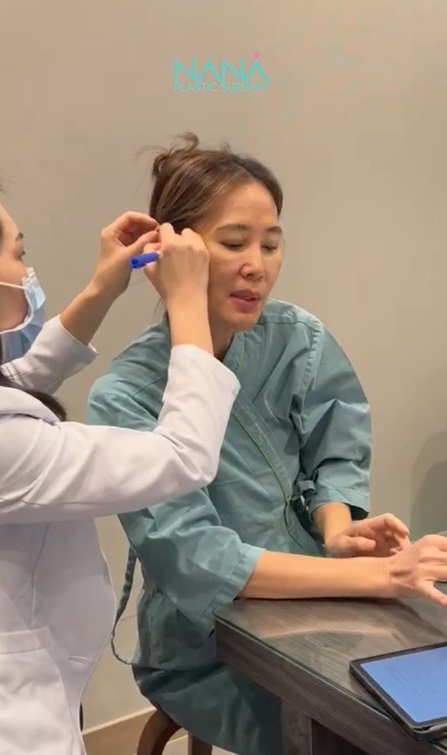 Bagian-bagian wajah Jeremy dan Ina yang akan dikerjakan pun ditandai terlebih dahulu. Dalam foto terlihat wajah Ina Thomas yang sedang diperiksa sebelum menjalani prosedur tersebut. Foto: Instagram/@nanahospital.id