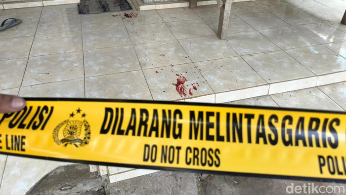 Istri yang dibacok suami di Probolinggo.