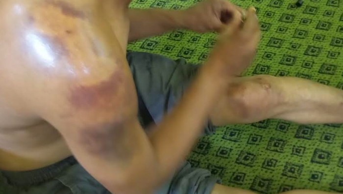 Kondisi warga di Bone yang mengaku dianiaya oknum polisi Polsek Ajangale.