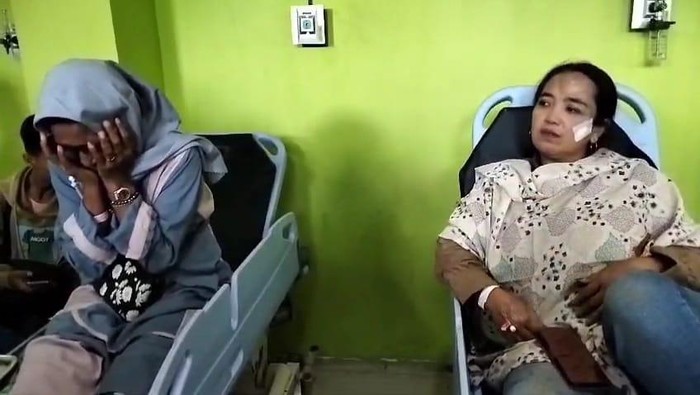 Yayuk (kiri) dan Rohiyati (kanan) penumpang selamat dalam kecelakaan maut di Tol Kebomas.