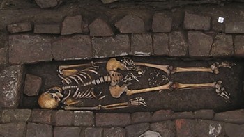 Kerangka hamil: Sekitar 1.300 tahun lalu, seorang wanita di Imola, Italia, meninggal beberapa minggu sebelum melahirkan. Arkeolog menemukan kerangka janin di antara kedua kakinya. Namun ilmuwan lebih tertarik pada temuan lain, seseorang membuat lubang kecil di tengkoraknya sebelum meninggal. Mengebor lubang seperti itu disebut trepanasi, telah dilakukan sepanjang sejarah untuk mengobati cedera kepala dan mungkin untuk mengusir roh jahat. Dalam kasus ini, peneliti bertanya-tanya apakah dia menderita preeklamsia, kondisi yang berhubungan dengan kehamilan yang melibatkan tekanan darah sangat tinggi dan kemungkinan kejang. Foto: Live Science