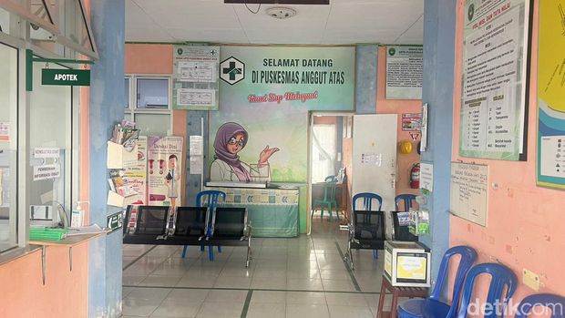 Puskesmas Anggut Atas Kota Bengkulu memiliki program dengan nama unik yakni Jebol Ya Mas. Nama tersebut dipilih agar masyarakat lebih mudah mengingat dan mengenal program kesehatan tersebut.