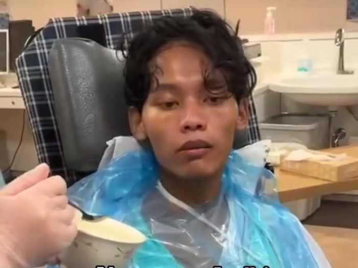 Ardhi TKI asal Sragen menjalani perawatan di Jepang.