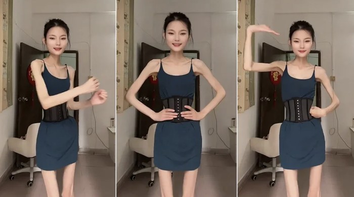 Bak Tengkorak Hidup, Wanita Berbobot 25 Kg Ini Masih Ingin Turun BB