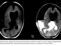 Kasus Tak Biasa, Ramai Penampakan Janin 18 Cm di Kepala Anak 1 Tahun