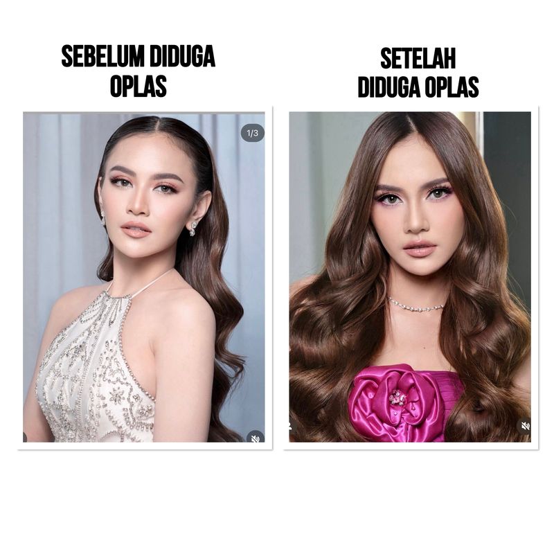 Mahalini sebelum vs setelah diduga oplas