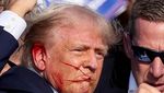 Begini Kondisi Donald Trump usai Jadi Korban Penembakan