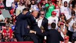 Begini Kondisi Donald Trump usai Jadi Korban Penembakan
