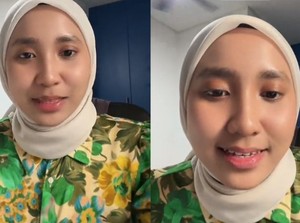 Viral Wanita Tertular Herpes gegara Mencoba Tester Lipstik