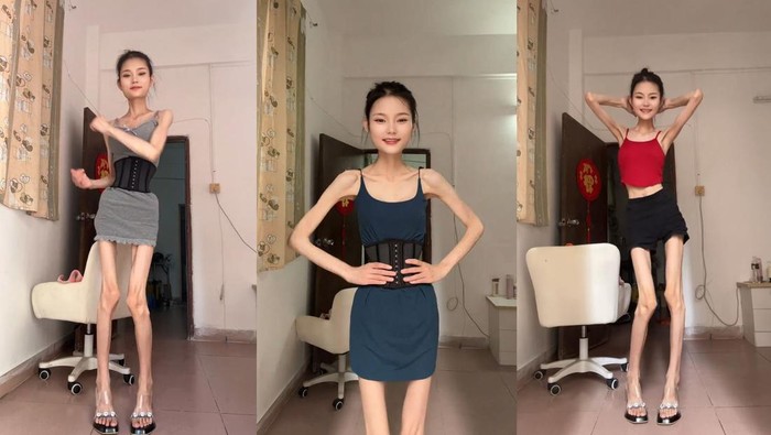 Wanita di China viral karena memiliki berat badan hanya 25 kg