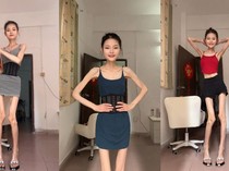 Bak Kerangka Hidup, Wanita China Ini Berat Badannya Cuma 25 Kg