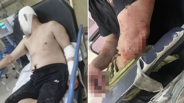 Parah! 12 Pencuri Serang Petani dan Rampas Durian Rp 10 Juta