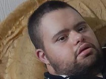 Pilu Pria Down Syndrome Diserang Anjing Militer Israel-Meninggal