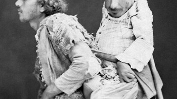 Seorang Muslim Buta Bernama Muhammad Menggendong Sahabatnya Seorang Kristen Lumpuh Yang Menderita Dwarfisme Bernama Samir, Damaskus, Ottoman Suriah, 1889 Foto: via Boredpanda