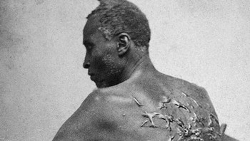 Seorang Mantan Budak Bernama Gordon Menunjukkan Bekas Lukanya Yang Mencambuk. Baton Rouge, Louisiana, tahun 1863 Foto: via Boredpanda