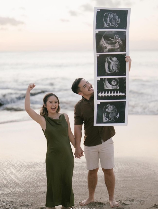 Uniknya tak hanya hasil USG berukuran normal, rupanya pasutri tersebut sudah menyiapkan hasil USG berukuran besar untuk properti pemotretan mereka. Foto: Instagraam/@gritteagathaa