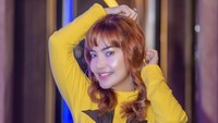 Irma Darmawangsa ternyata mengikuti tren para selebriti lain yang melakukan operasi plastik. Uniknya ia memilih dokter kecantikan lokal. Foto: Instagram/irmadarmawangsa