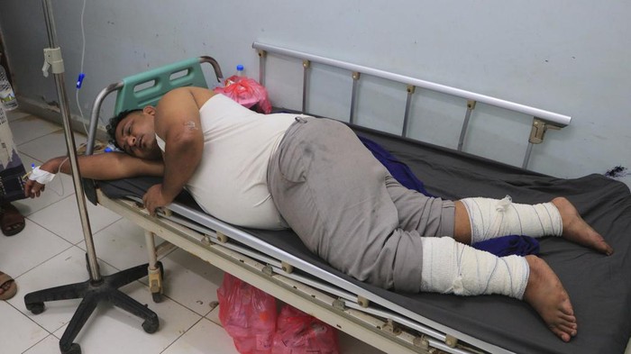 Yemen Israel Palestinians Serangan balasan Israel ke wilayah yang dikuasai Houthi di pelabuhan Yaman menewaskan tiga orang dan melukai puluhan lainnya. Begini kondisi korban lukanya.