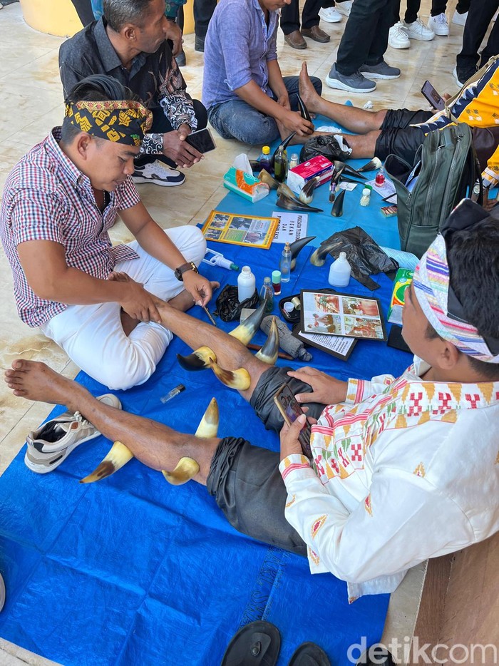 Abdul Gofur atau yang biasa disapa Cak Dultengah memasangkan media bekam tanduk sapi pada salah satu pasiennya di lorong Masjid Hubbul Wathan Islamic Center, Minggu (21/7/2024). (Nathea Citra/detikBali)