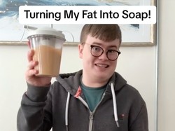 Unik Tapi Bikin Jijik, Pria ini Bikin Sabun Dari Hasil Sedot Lemaknya