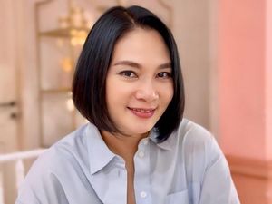Dian Nitami Pamer Wajah Usai Face Lift di Korea Selatan, Dipuji Makin Cantik