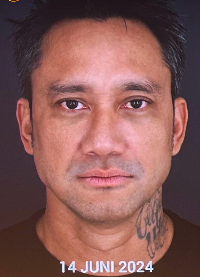 Tampak perbedaan yang lebih signifikan dari wajah Tora. Menurut Dr. Jill Silfanus dari Miracle Clinic. Sebelumnya wajah Tora Sudiro mengalami beberapa masalah seiring bertambahnya usia. Foto: dok. Instagram