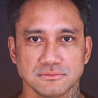 Tampak perbedaan yang lebih signifikan dari wajah Tora. Menurut Dr. Jill Silfanus dari Miracle Clinic. Sebelumnya wajah Tora Sudiro mengalami beberapa masalah seiring bertambahnya usia. Foto: dok. Instagram