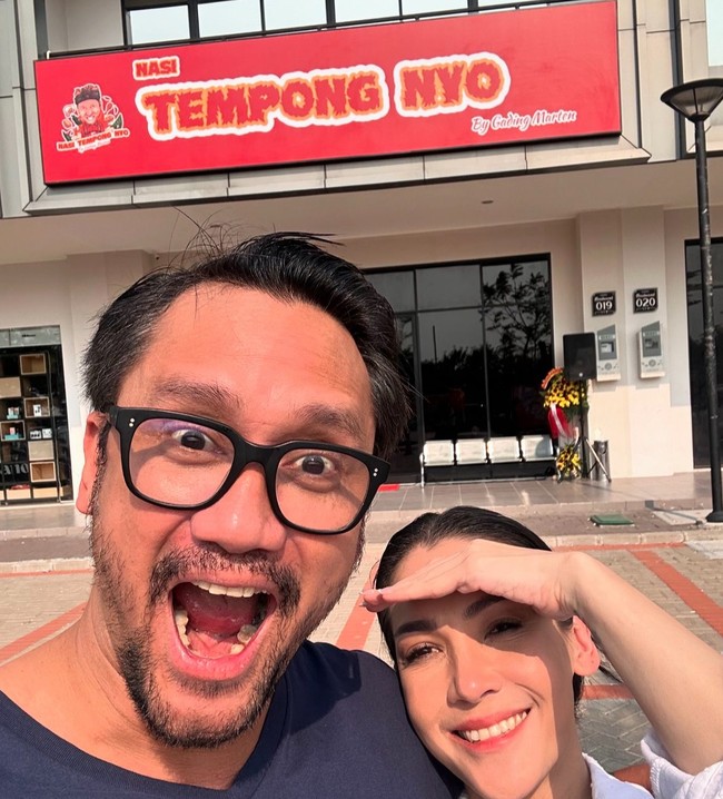 Tora Sudiro sendiri merasa puas dengan hasilnya. Saya merasa lebih muda setelah perawatan ini. Istri saya bahkan cemburu karena penampilan saya yang lebih segar,” candanya. Foto: dok. Instagram