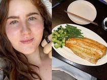 Punya Lebih dari 100 Alergi, Wanita Ini Hanya Bisa Konsumsi 13 Jenis Makanan