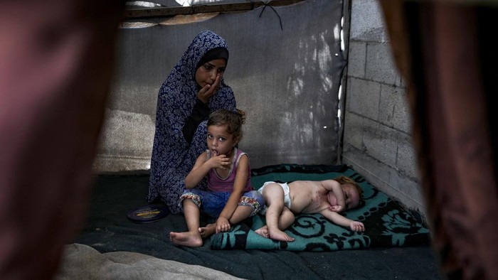 Displaced child Sham al-Hessi, center, who suffers from skin disease, is covered with skin cream as she poses for a picture, at a makeshift tent camp in Deir al-Balah, central Gaza Strip, Monday, July 29, 2024. Skin diseases are running rampant in Gaza, health officials say, from appalling conditions in overcrowded tent camps housing hundreds of thousands of Palestinians driven from their homes. (AP Photo/Abdel Kareem Hana )