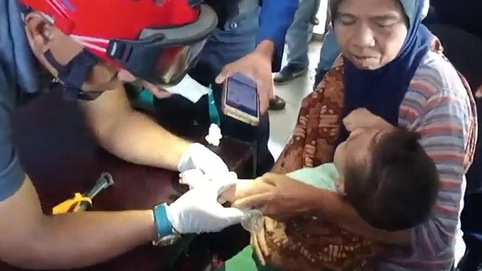 Petugas Damkar Tanjungbalai saat berusaha melepaskan cincin dari jari tangan bayi. (Istimewa)