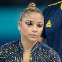 Siaran NBC menunjukkan momen jatuhnya Saraiva, dan terlihat jelas bahwa ia mengalami luka di area dahi, tepatnya di atas mata kanannya  serta memar di bawahnya. Meskipun demikian, semangat juangnya tidak surut.  Foto: Getty Images