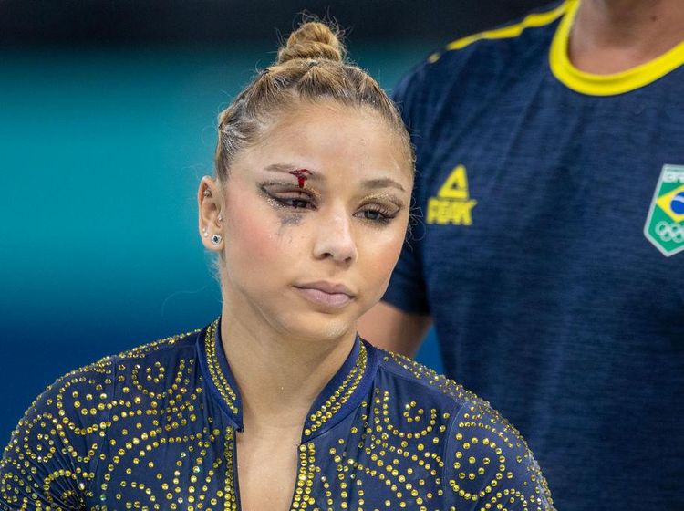 Momen Atlet Senam Artistik Jatuh dan Dahinya Terluka di Olimpiade Paris 2024