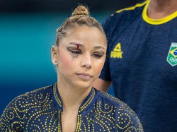 Momen Atlet Senam Artistik Jatuh dan Dahinya Terluka di Olimpiade Paris 2024