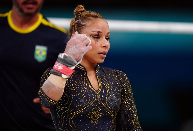 Saraiva melanjutkan pertandingan. Dia berhasil mengatasi rasa sakit yang dirasakannya dan mencetak skor 13.666 pada palang bertingkat untuk memulai final tim. Foto: Getty Images