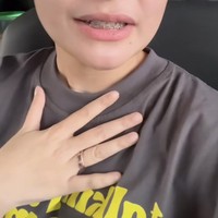 Prilly mengaku masih belum terbiasa menggunakan behel. Ia merasa kesulitan saat harus menutup bibirnya dan mengatakan jika mulutnya itu masih terasa sakit. Foto: Instagram/@prillylatuconsina96