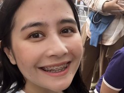 Totalitas Dalam Peran, Potret Penampilan Baru Prilly Latuconsina Pakai Behel