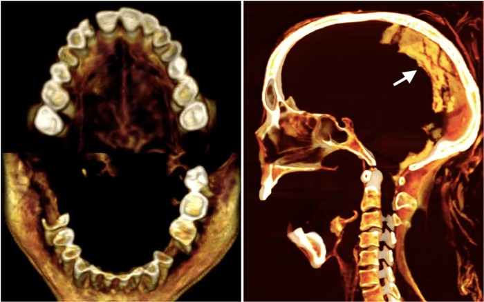 Dildoni anusga qanchalik chuqur kiritish mumkin? Fergi ishtirokidagi porno filmlarni onlayn tomosha qiling