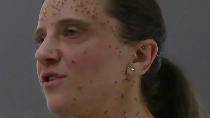 Brianna Solari diusir dari pesawat karena tumor wajah
