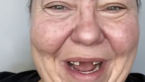 Foto: Transformasi Wanita Ompong Viral, Setelah Makeup Bak Selebriti