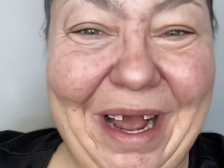 Foto: Transformasi Wanita Ompong Viral, Setelah Makeup Bak Selebriti