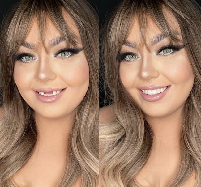 Sarah Andres yang dikenal dengan akun media sosialnya Lashes and Losing menampilkan transformasi wajahnya sebelum dan sesudah makeup atau sebaliknya. Foto: dok. Instagram @lashesandlosing