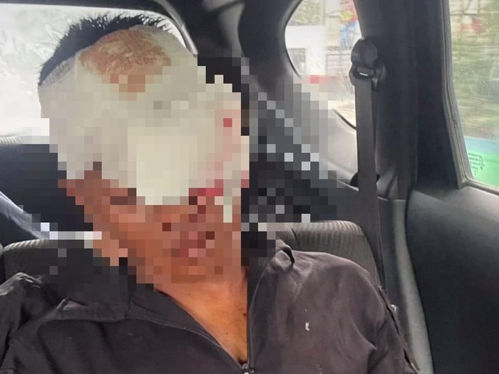 Kondisi Prada D usai diduga dikeroyok.