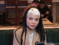 Dinar Candy Bicara Kelanjutan Hubungan dengan Koh Apex