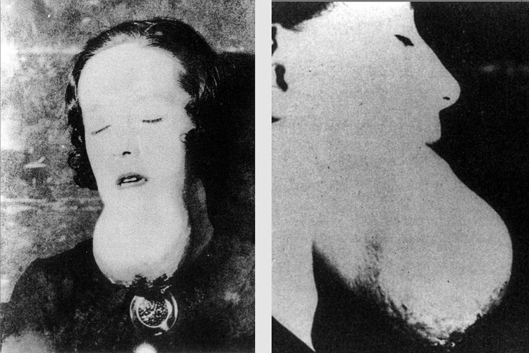 Foto Sejarah Mengerikan Foto Sejarah Mengerikan