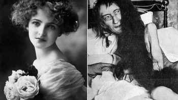 Blanche Monnier, seorang gadis Prancis yang dikurung oleh ibunya selama 25 tahun Foto: Historydefined