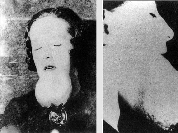 Foto Paling Mengerikan dalam Sejarah