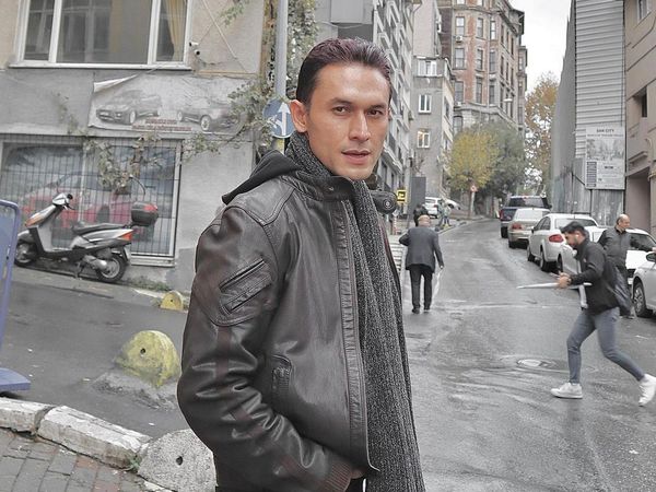 Penampilan Indra Bruggman Pascaoperasi Plastik Kantung Mata