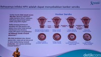 Menyambut Hari Kemerdekaan Republik Indonesia, MSD Indonesia bersama Kementerian Kesehatan dan Bio Farma meluncurkan kampanye edukasi kesehatan bertajuk “Tenang untuk Menang” dengan mengangkat tema “Perempuan Indonesia Merdeka dari Bahaya Kanker Leher Rahim” di Jakarta (13/8/2024).
