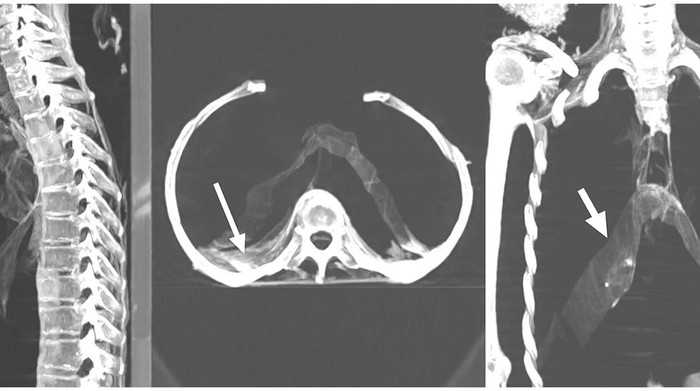 Penampakan mumi wanita menjerit.